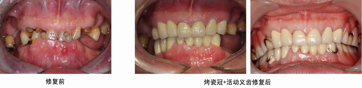 mg冰球突破豪华版试玩(中国)官方网站