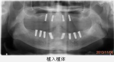 mg冰球突破豪华版试玩(中国)官方网站