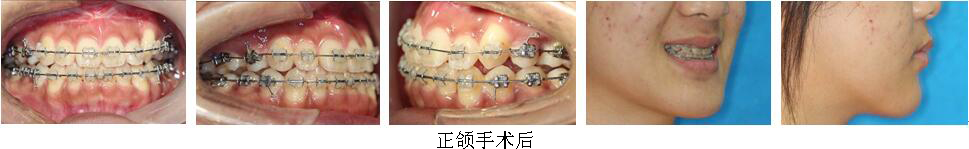 mg冰球突破豪华版试玩(中国)官方网站