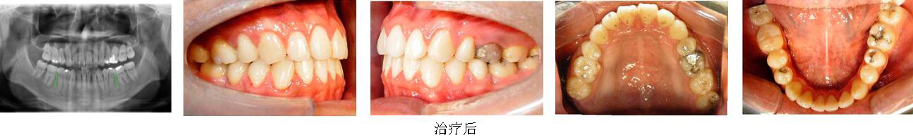 mg冰球突破豪华版试玩(中国)官方网站