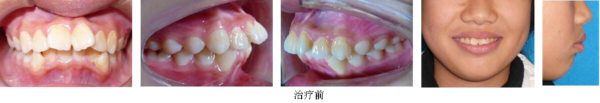 mg冰球突破豪华版试玩(中国)官方网站