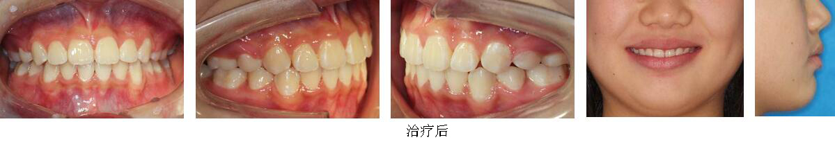 mg冰球突破豪华版试玩(中国)官方网站