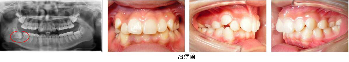 mg冰球突破豪华版试玩(中国)官方网站