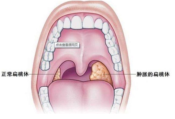 mg冰球突破豪华版试玩(中国)官方网站