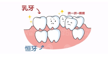 mg冰球突破豪华版试玩(中国)官方网站