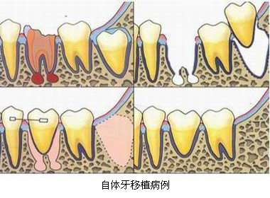 mg冰球突破豪华版试玩(中国)官方网站