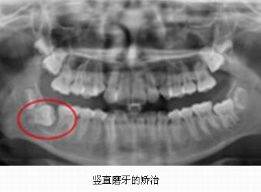 mg冰球突破豪华版试玩(中国)官方网站