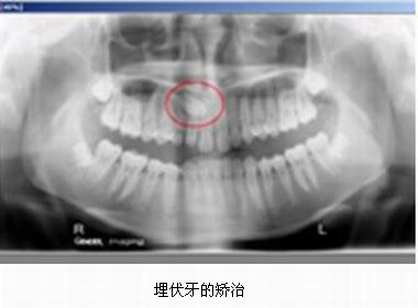 mg冰球突破豪华版试玩(中国)官方网站