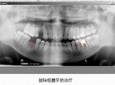 mg冰球突破豪华版试玩(中国)官方网站