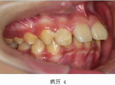 mg冰球突破豪华版试玩(中国)官方网站